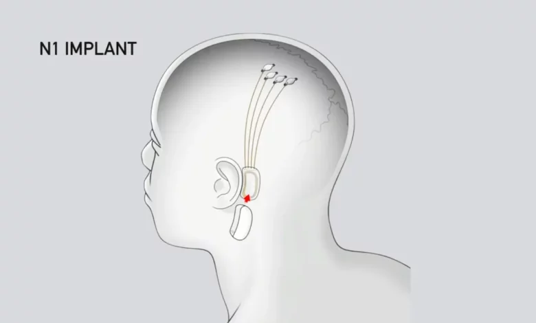 Neuralink Gets FDA Approval for Pioneering Neurotech Clinical Trial